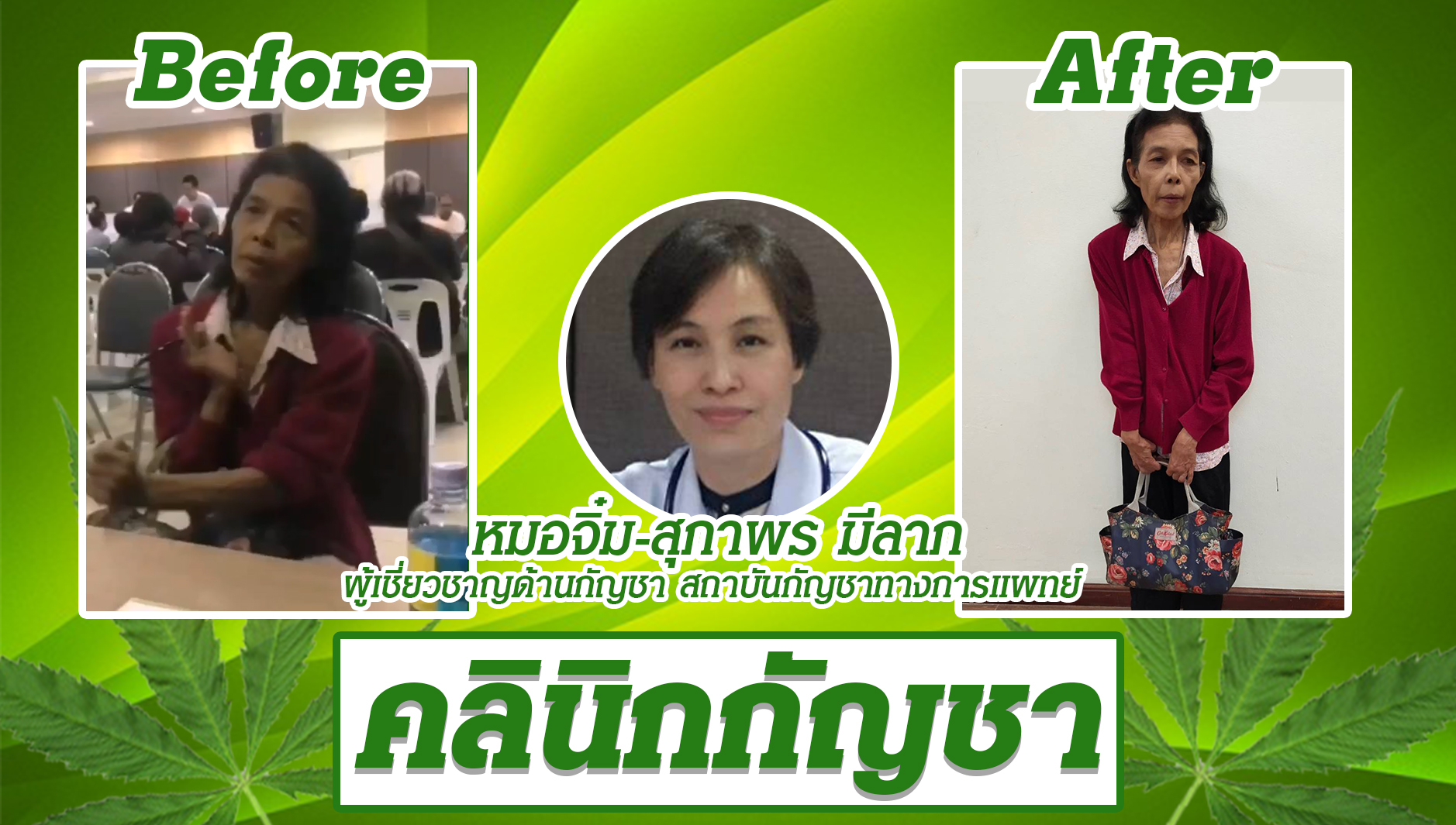 หมอคลินิกกัญชา โพสต์ น้ำตาซึม! ผู้ป่วย “พาร์กินสัน” หลังได้รับยากัญชา CBD 20 ดรอป ใน 10 นาที พบอาการดีขึ้นอย่างน่ามหัศจรรย์